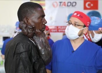 جمعية أصدقاء كل إفريقيا التركية تعالج أوغندي من كتلة ضخمة في وجهه