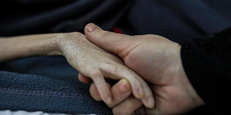 قطاع غزة.. 57 وفاة جراء سياسة التجويع الإسرائيلية منذ 7 أكتوبر 2023