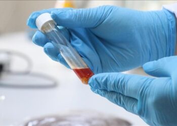 تركيا.. باحثون ينتجون زيتا أحادي الخلية من بقايا العنب