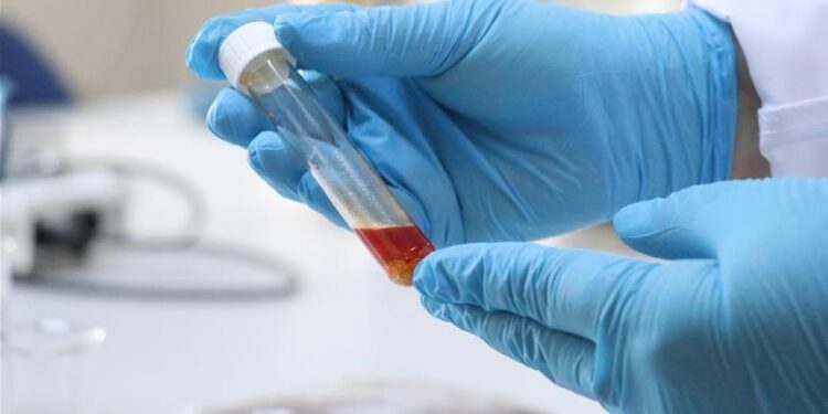 تركيا.. باحثون ينتجون زيتا أحادي الخلية من بقايا العنب