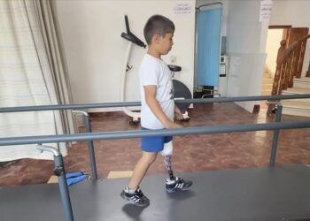 جمعية صدقة طاشي التركية تركب أطرافا صناعية لمصابين فلسطينيين من غزة