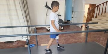 جمعية صدقة طاشي التركية تركب أطرافا صناعية لمصابين فلسطينيين من غزة