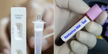 هانتا في الإعلام التركي.. ليس كورونا لكن الخطر قائم